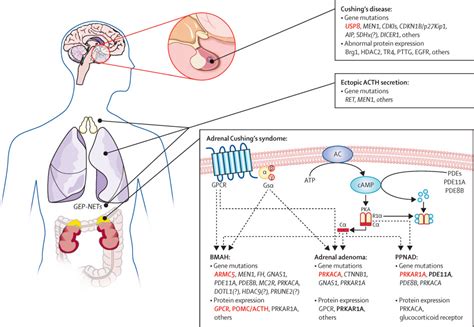 Unusual infections and thrombotic events in Cushing's syndrome